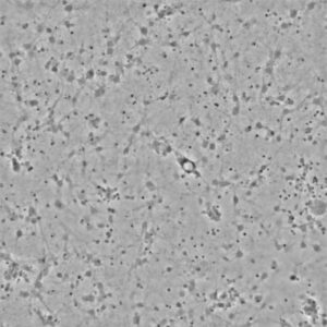 Cell Dispensing In A High Content Primary Neuron Based Screening