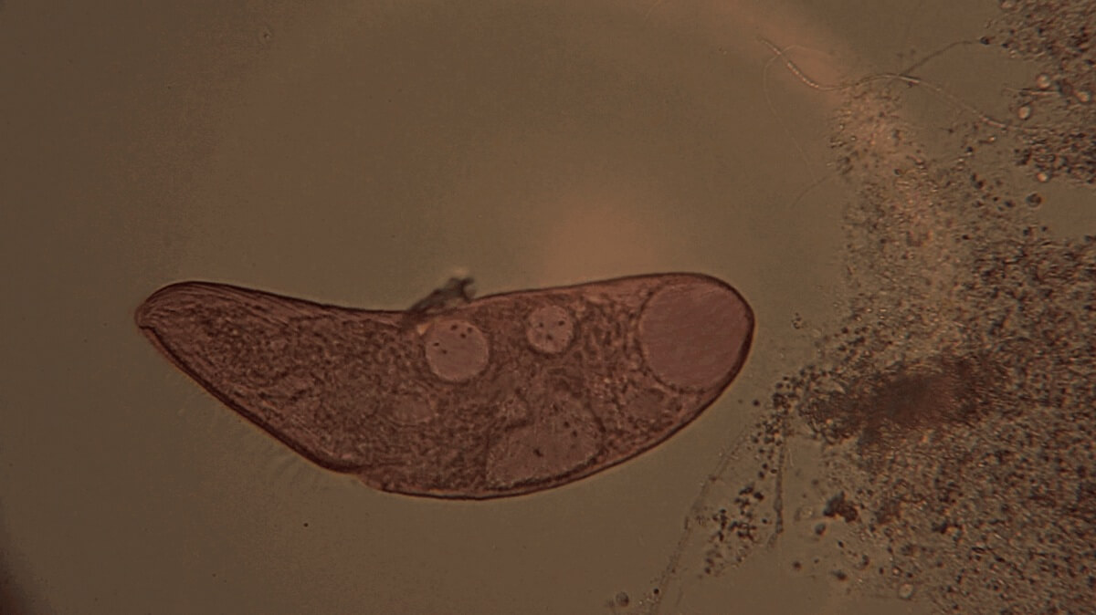 Single cell rna seq